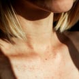 5 Little-Known Tips For Eczema That Actually Work, According to Derms